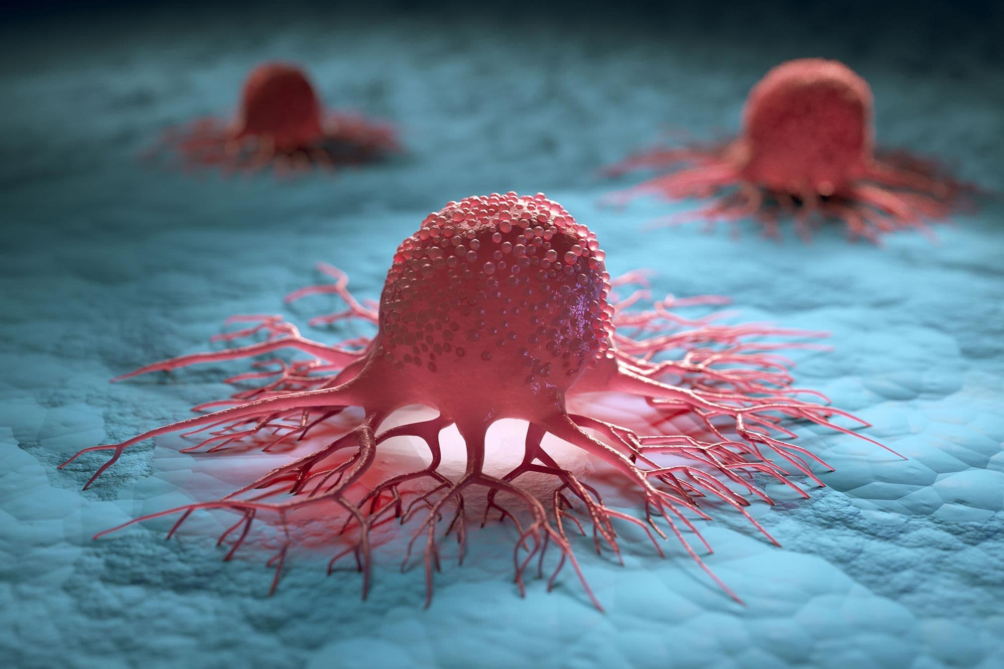 Report: 10% of Cancer Cases in Europe are Linked to Pollution